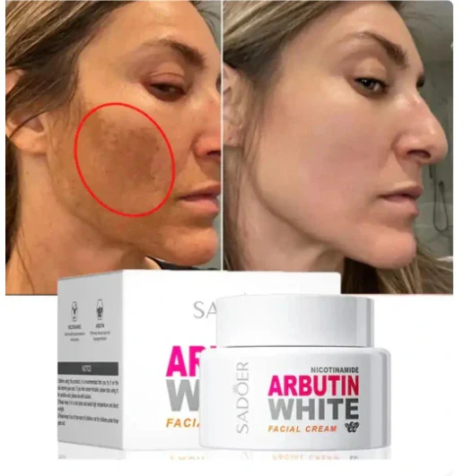 ✨ lleva 3 Arbutin White + 1 Elixir Antiedad de regalo! Dile adiós a las manchas y al acné revela tu verdadera piel 💖